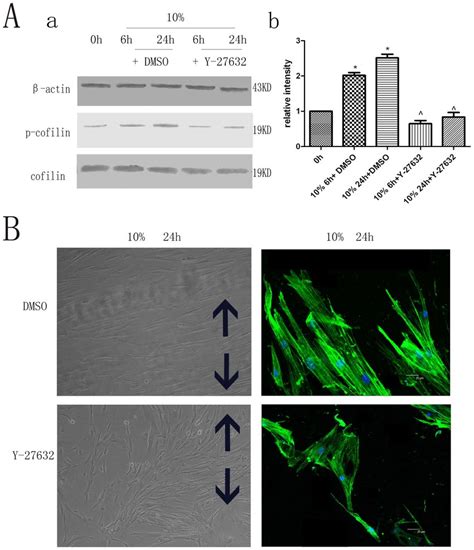 Rock Specific Inhibitor Y 27632 And Its Effect On Hpdlc Cytoskeletal Download Scientific