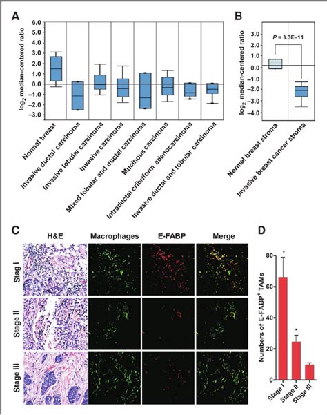 E FABP Expression In TAMs Of Human Breast Cancer A Analysis Of E FABP