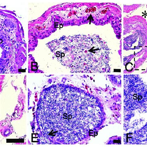 Flow Cytometry Analysis Using Annexin V And Propidium Iodide Pi