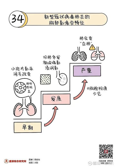 知识卡片 一分钟看懂，新型肺炎病变全过程 只有了解病毒，才能战胜病毒。 为了向广大群众普及新型冠状病毒的知识，帮助大家正确地认识和防范病毒，缓解焦虑和恐慌。湖北科 雪球