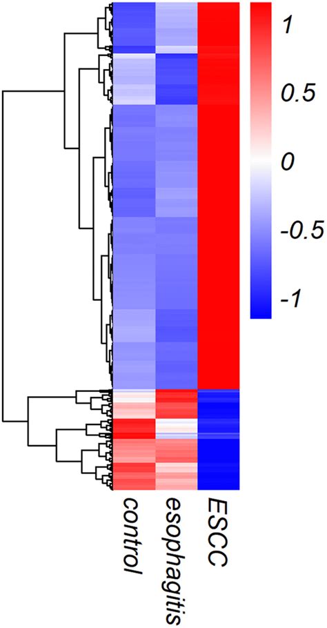 Five Lncrna Signature In Plasma Exosomes Serves As Diagnostic Biomarker