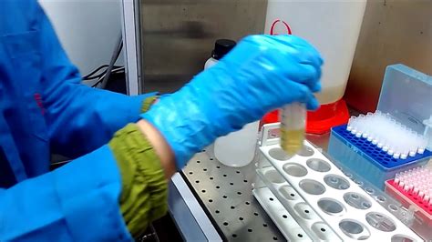 Cell Free Dna Extraction Youtube