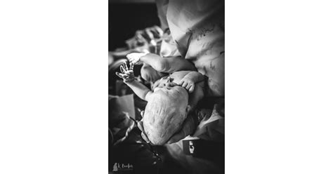 Newborn Head Molding During Birth | POPSUGAR Family Photo 8