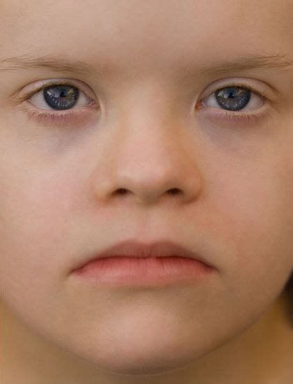 Mental Retardation Baby Symptoms Average Definition Description