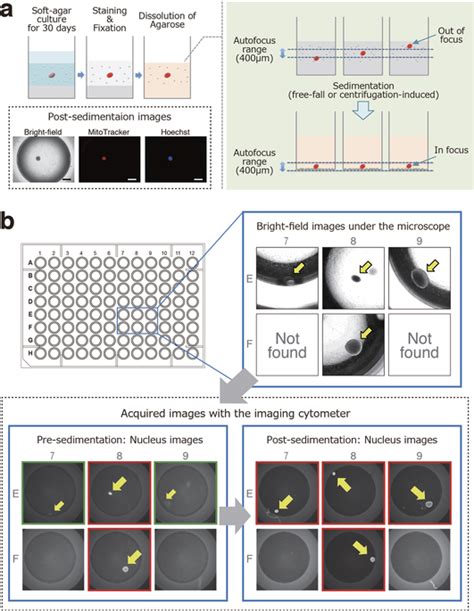 High Precision 2d Imaging Of Colonies In Soft Agar Culture Using The Download Scientific