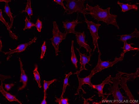 SLC3A2 Fusion Protein Ag7280 Proteintech 武汉三鹰生物技术有限公司