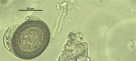 El Parásito Del Mes Taenia Saginata Y La Cisticercosis Bovina Parasitxpert