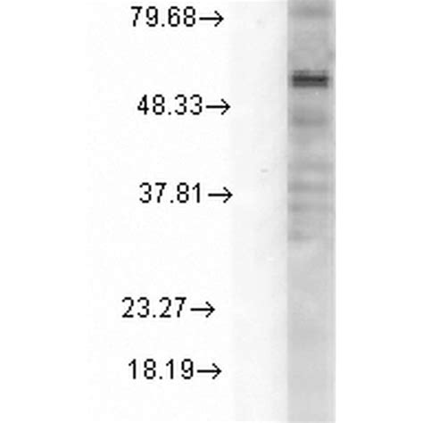 Anti δ GABA A Receptor Antibody QED Bioscience Inc