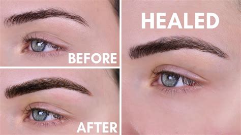 Microblading Experience Before After 10 Day Healing Process