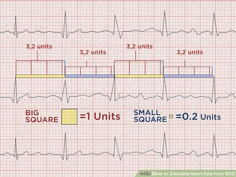 How To Calculate Heart Rate From Ecg 8 Steps With Pictures