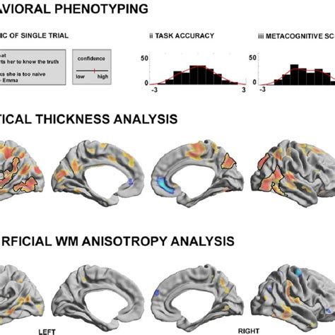 A Dualist Model Of The Causal Sequence In Visual Perception Light