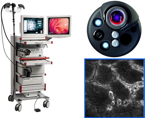 Confocal Laser Endomicroscopy Technical Advances And Clinical