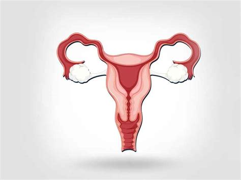 Endometrial Hyperplasia Causes Symptoms And Treatment Options