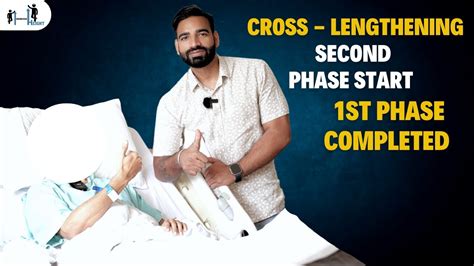 Cross Lengthening Second Phase Start Height Increase Surgery Limb