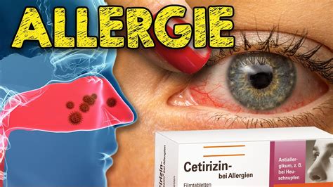 Allergien Deswegen Reagiert Dein Immunsystem Ber Effektive Ans Tze