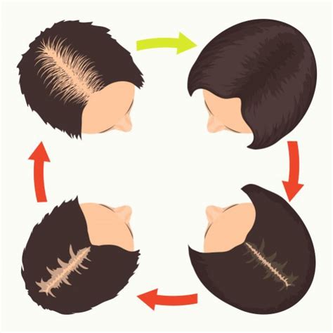 The Solution For Female Pattern Baldness