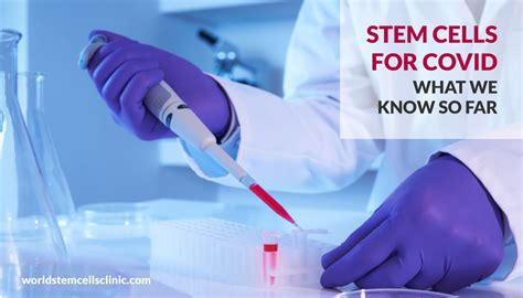 Stem Cells For Covid What We Know So Far World Stem Cells Clinic