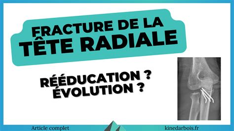 Fracture T Te Radiale Coude R Ducation Gu Rison Conseils Kin