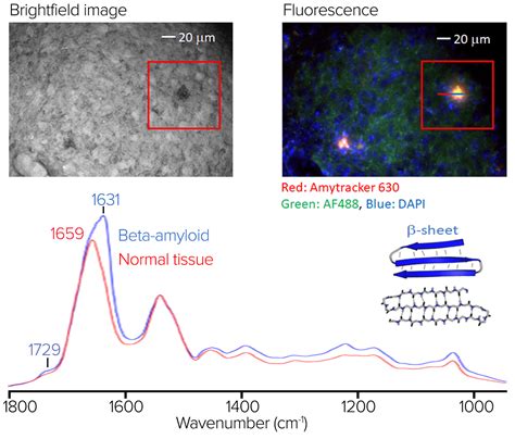 Life Science Applications Of Submicron IR And Raman Microscopy