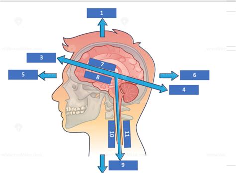 Neuro Quiz Photos Flashcards Quizlet