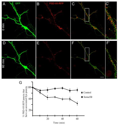 Postsynaptic Density PSD 95 Puncta Are Eliminated Upon Treatment With