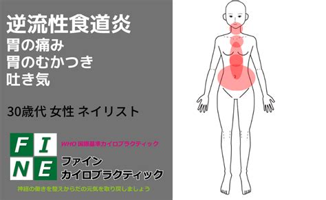 胃の痛み（むかつき感）こみ上げる感じ・逆流性食道炎の症状の方が宮城県多賀城市よりご来院。症状が改善されました