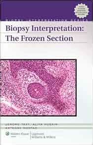 Biopsy Interpretation The Frozen Section Biopsy Interpretation Series