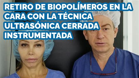 Retiro De Biopol Meros En La Cara Con La T Cnica Ultras Nica Cerrada