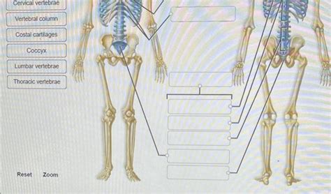 Solved Correctly Label The Following Bones Of The Axial