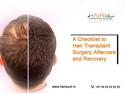 A Checklist To Hair Transplant Surgery Aftercare And Recovery Hair Sure