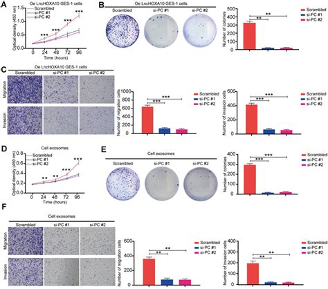 Silencing Of Pc Inhibited The Function Of Exosomal Lnchoxa10 A Oe