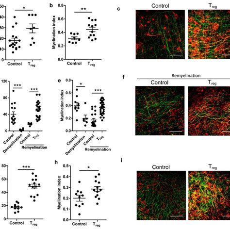 T Reg Are Required For Efficient Opc Differentiation And Remyelination