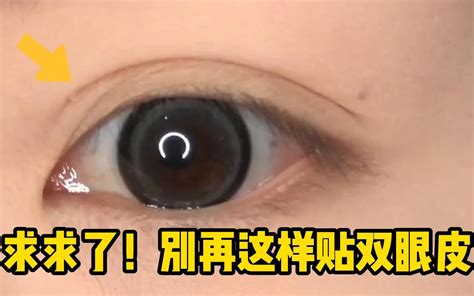 全切双眼皮3d动画演示 Bilibilib站无水印视频解析——yiuios易柚斯