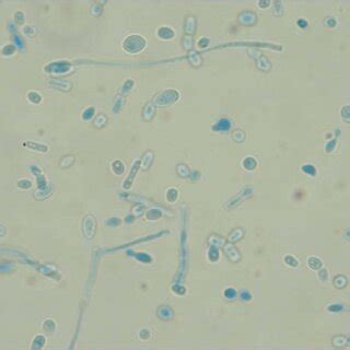 specimen lactophenol cotton blue stain