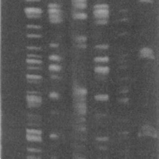 Macrorestriction Fragment Analysis Of Desulfornicrobium Apsheronurn