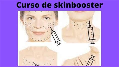 Curso De Skinbooster Skinbooster Microagulhamento Skinbooster Aula