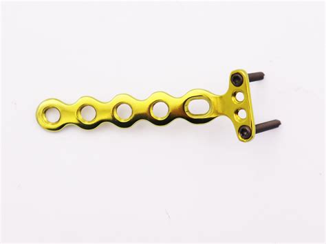 Orthopedic Intervention Implants Distal Radius Lateral Volar Joint