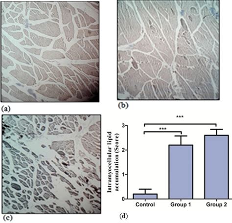 Sudan Black B Stained Skeletal Muscle Sections Of Control A Group 1