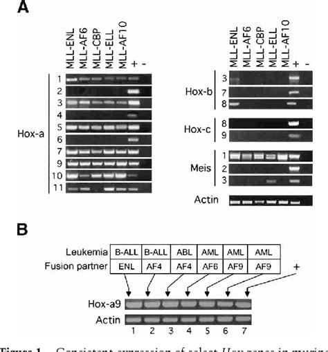 Figure 1 From Transformation Of Myeloid Progenitors By Mll Oncoproteins