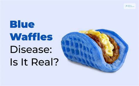 Is Blue Waffles Disease Real? | Everything You Need To Know!