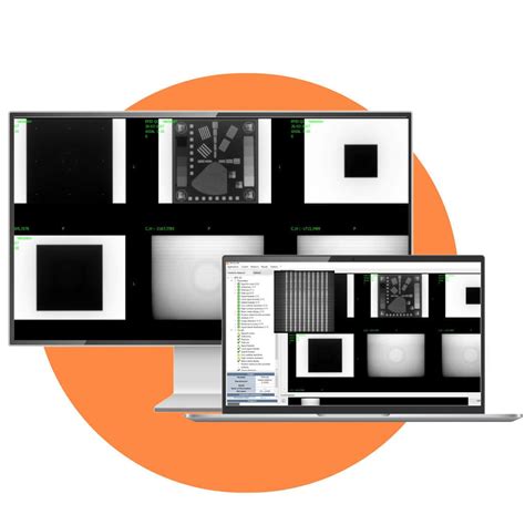 Diagnostic Management System Epid QA AQUILAB Signal For