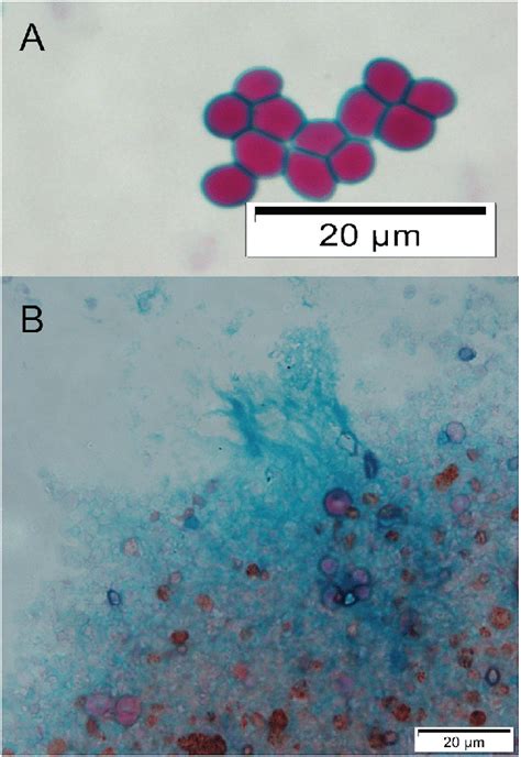 Bacterial Capsular Polysaccharides And Exopolysaccharides Image