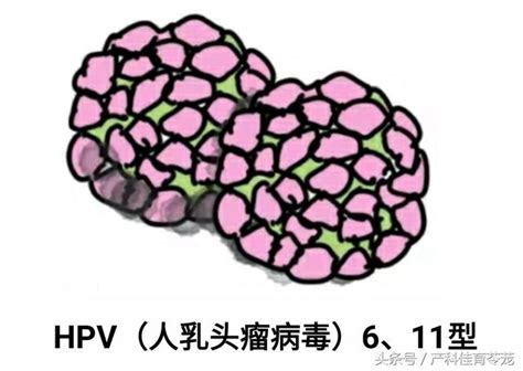 尖銳濕疣，預防很重要 每日頭條