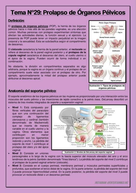 Prolapso De Rganos P Lvicos Entertainmed Inc Udocz