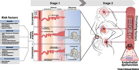 Missing Links In Preeclampsia Cell Model Systems Of Endothelial