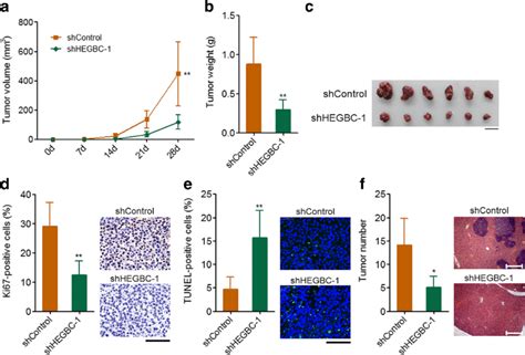 Depletion Of Hegbc Inhibited Gbc Growth And Metastasis In Vivo A Hegbc