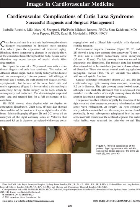 Cardiovascular Complications Of Cutis Laxa Syndrome Circulation