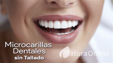 Sabes qué son las microcarillas dentales sin tallado Blog NaturaOnline