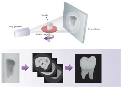 Micro Ct Scans — Dental Scan Centre Dental Scan Centre Medium