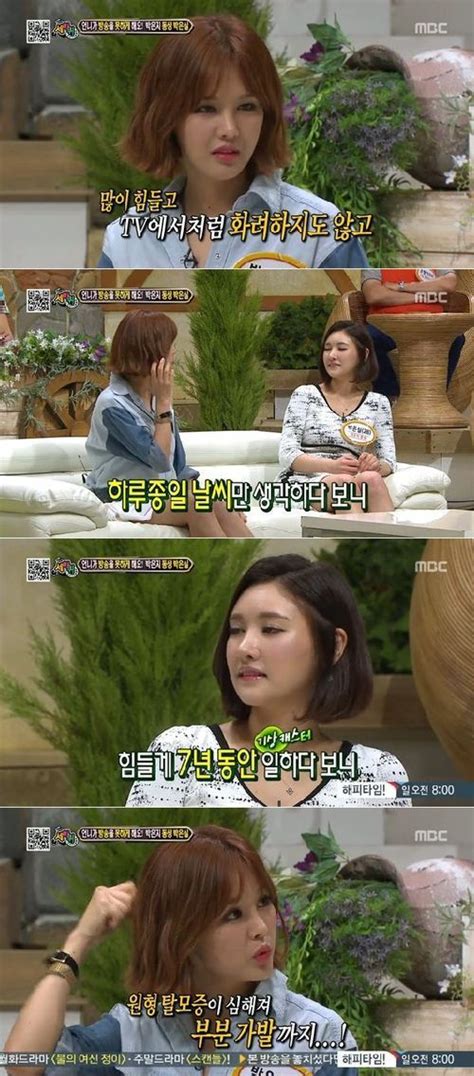 방송 박은지 탈모 고백 가짜 머리 똑딱이로 붙였다 Ytn